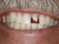 Konig Center for Cosmetic & Comprehensive Dentistry smile photos